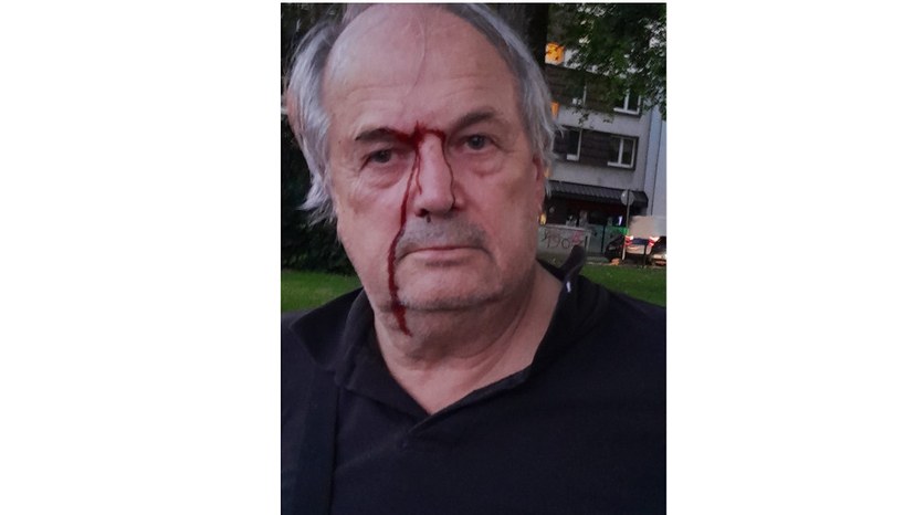 Roland Meister mit Verletzungen nach dem grundlosen, brutalen Polizeieinsatz